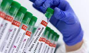 Sobe para 22 o número de casos de varíola dos macacos no Brasil
