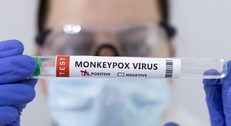Brasil vive ameaça de varíola do macaco ainda sem protocolo e insumos para testar casos suspeitos